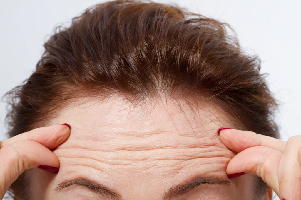 Should You Have a Forehead Botox? Doctor’s Review [2023]