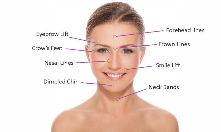 What Is Face Botox: Areas, Aftercare, Common Myths - Bellezie