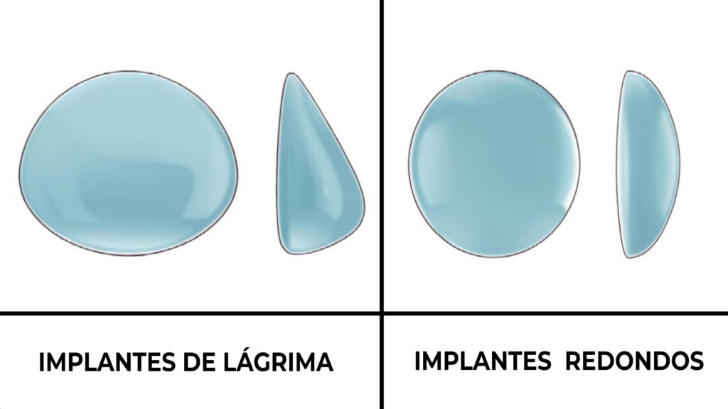 Tipos de implantes de aumento de seios
